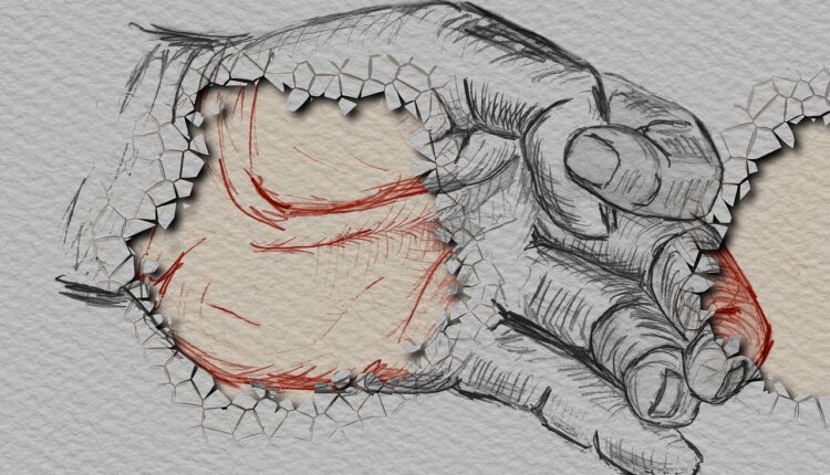 Sonhar com dedo quebrado alerta para limitações e dificuldades passageiras